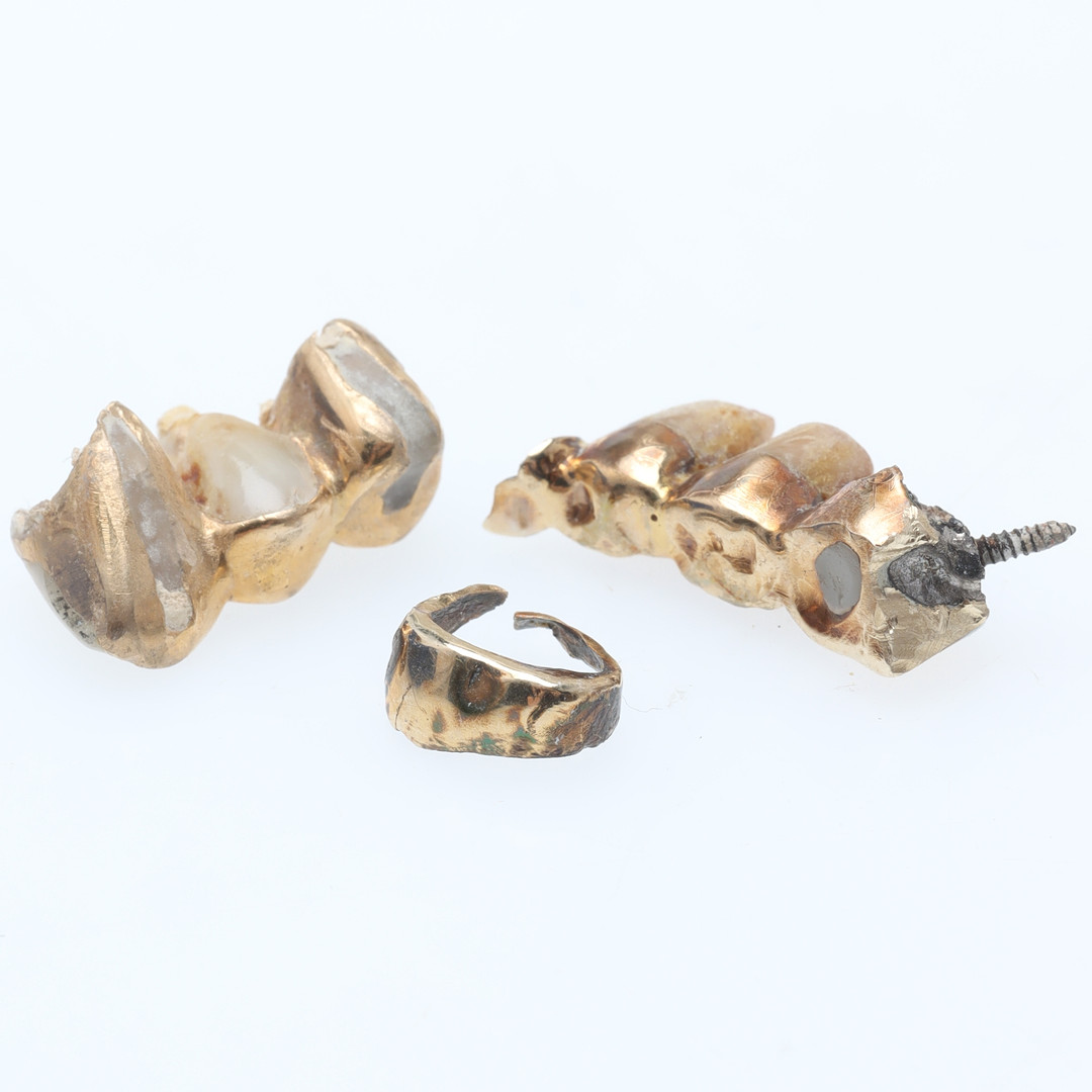 TANDGULD, orensat, ca 9,8 gram.