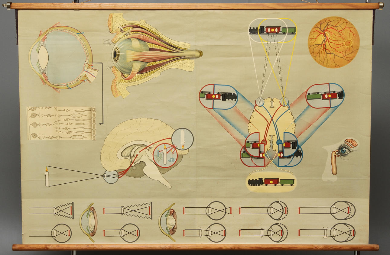 PLANSCH, Gumperts, Ögat.