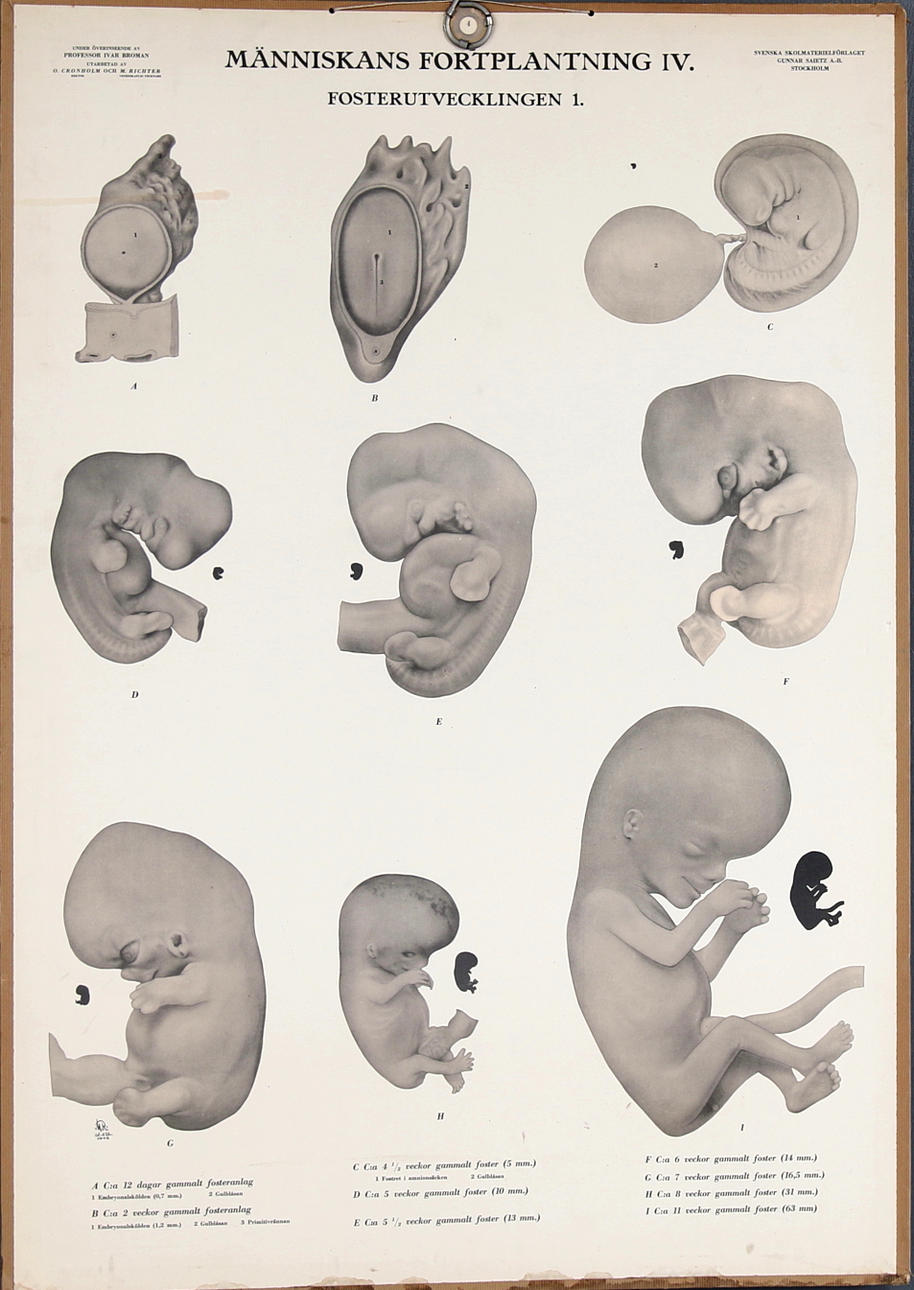 SKOLPLANSCHER, 2 st, "Människans fortplantning, fosterutveckling", O. Cronholm & M. Richter. 1900-talets första hälft.