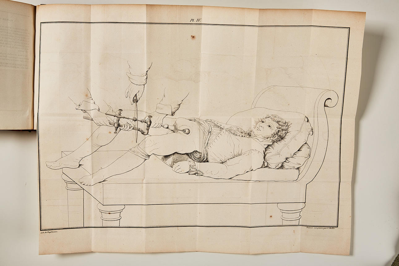 CIVIALE: DE LA LITHOTRITIE, PARIS 1827.