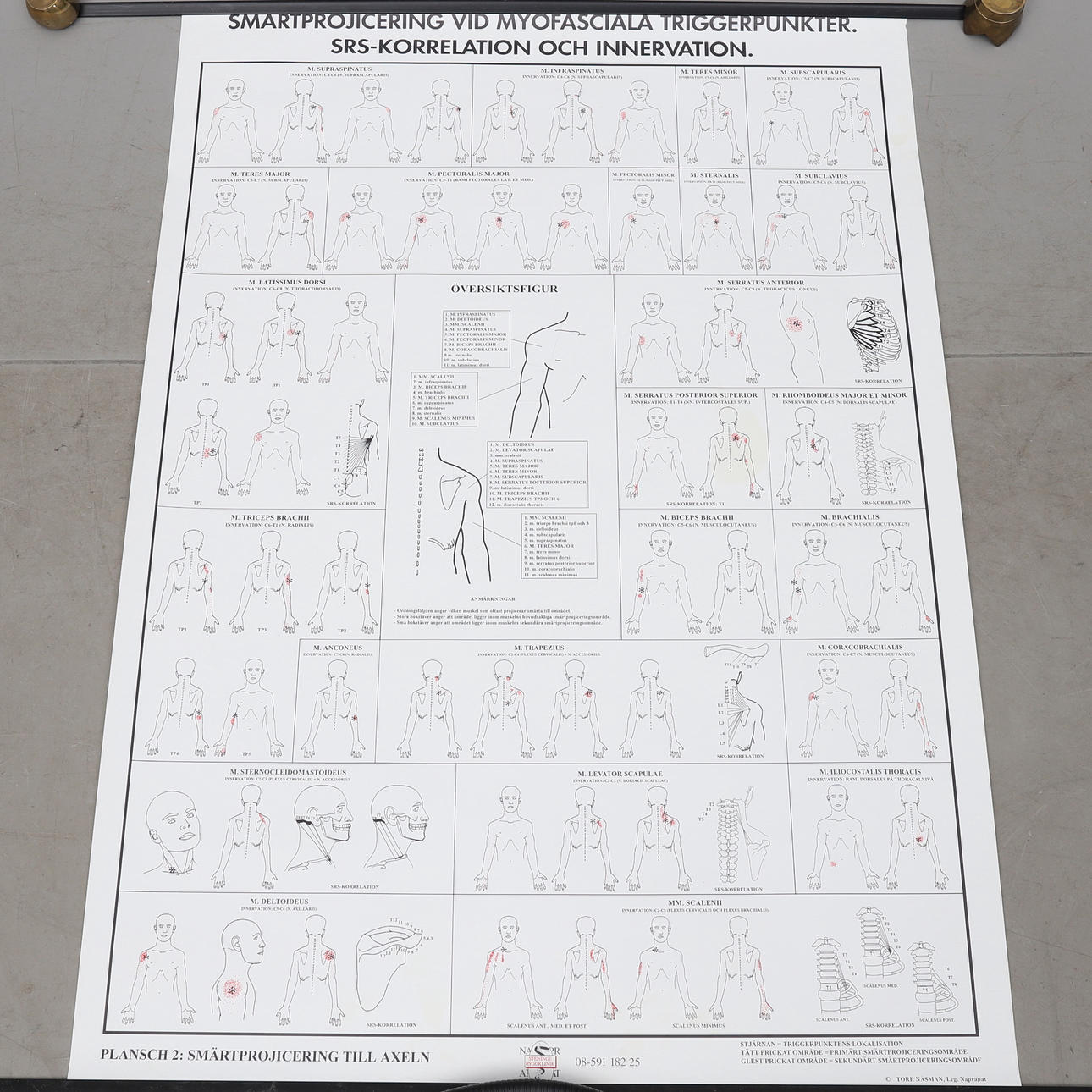 AFFISCHER, 3 st, "Smärtprojecering vid triggerpunkter", 1900-/2000-tal.
