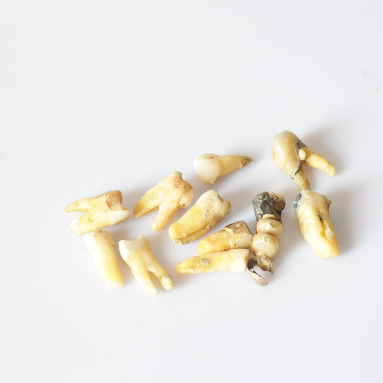 TANDGULD, orensat. Totalvikt ca 26,86 gram.