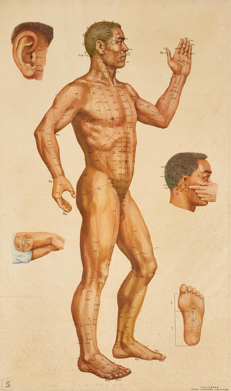 SCHOOL POSTER, acupuncture.