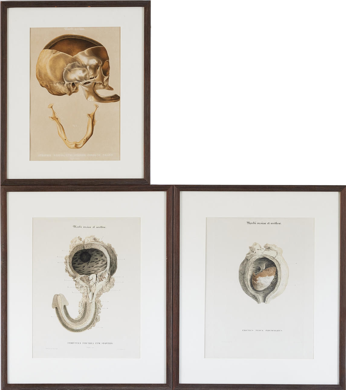 ANATOMISKE PLANER, RETZIUS, MAPPE OG INDRAMMEDE BILLEDER, 1855.