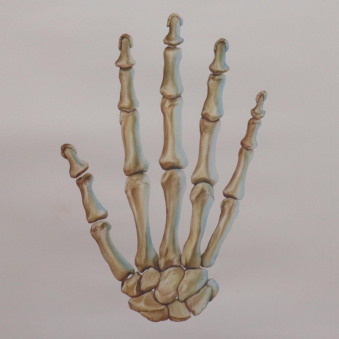 CARL-W. RÖHRIG. lithography, skeleton hand.