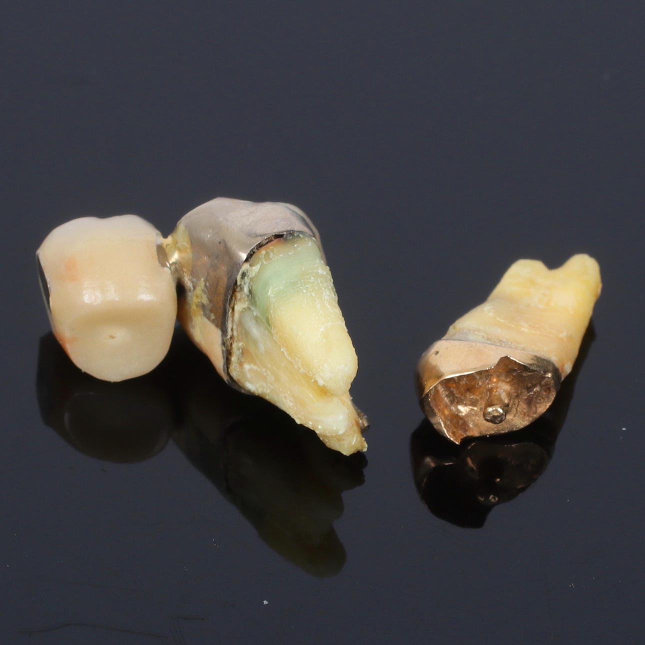 TANDGULD, 18k guld, 1900-tal.