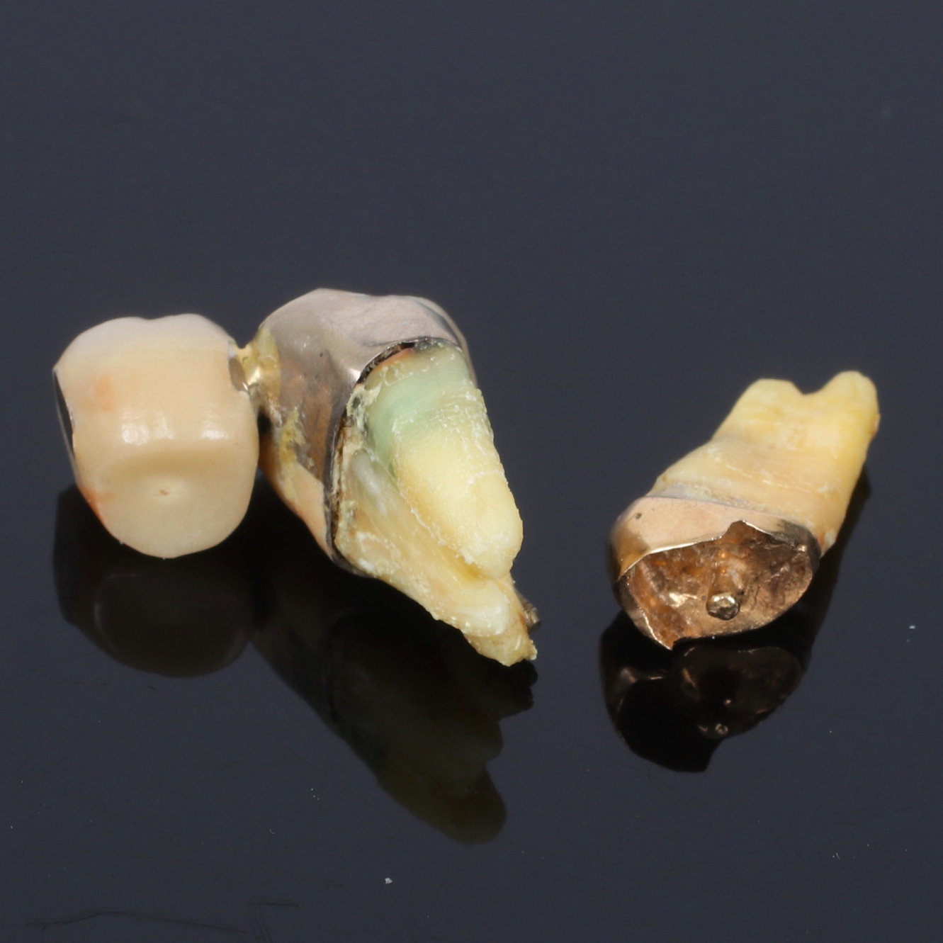 TANDGULD, 18k guld, 1900-tal.