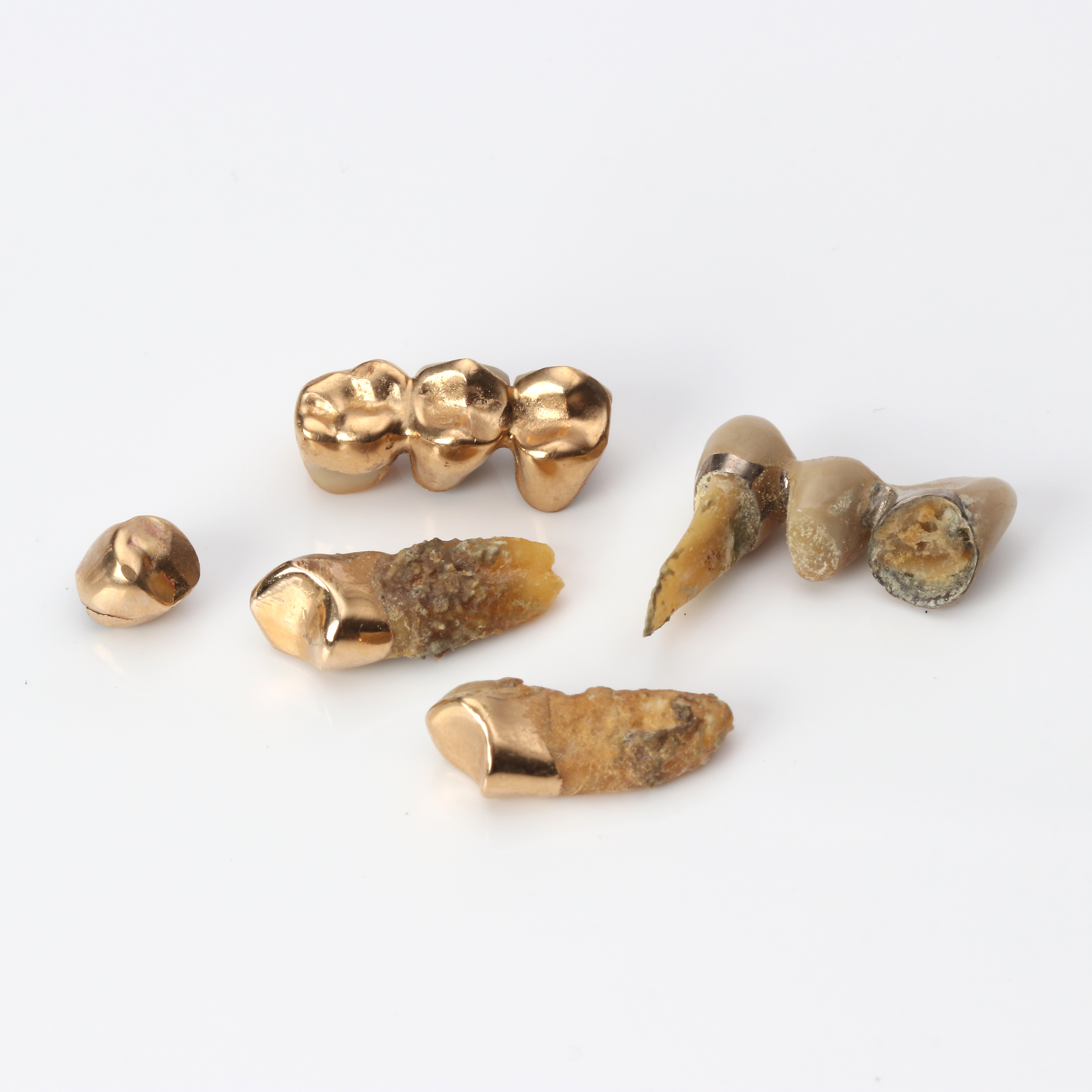 TANDGULD. Minst 18k guld, totalvikt ca 20,1 gram.