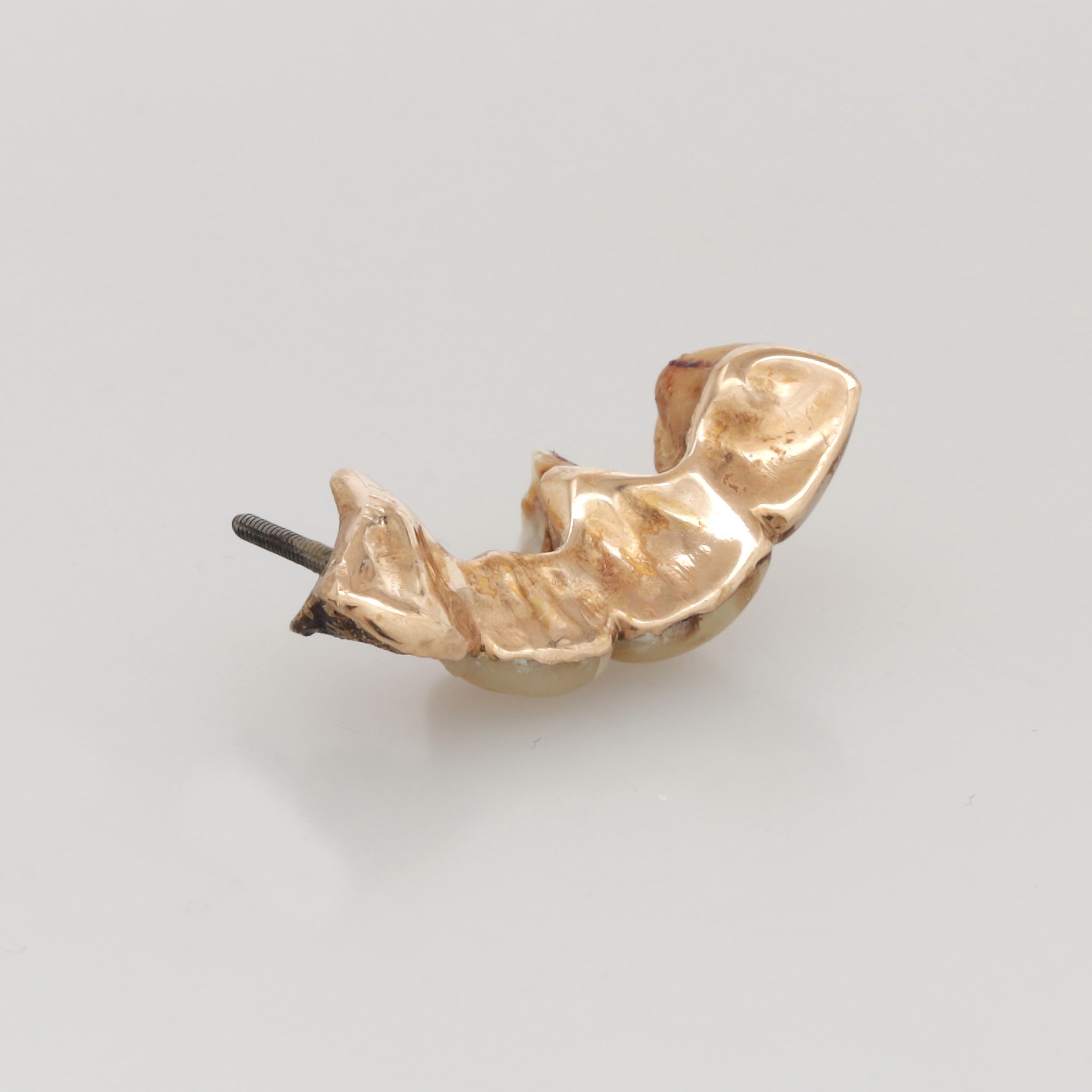 TANDGULD, totalvikt 6,32 gram.