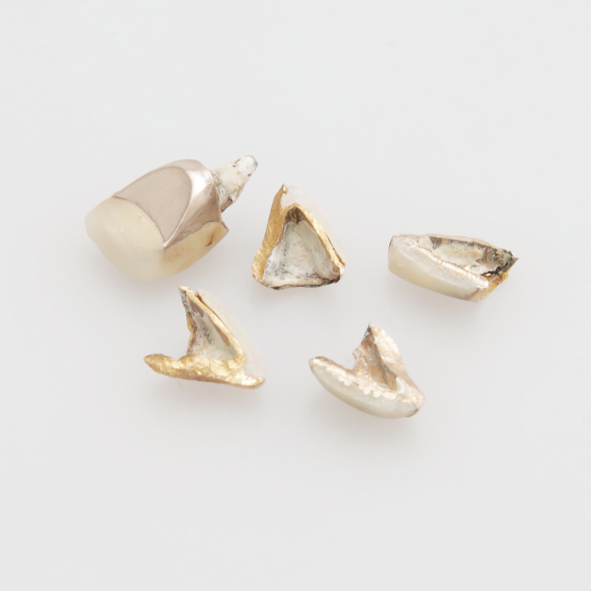 TANDGULD, totalvikt 6,78 gram.