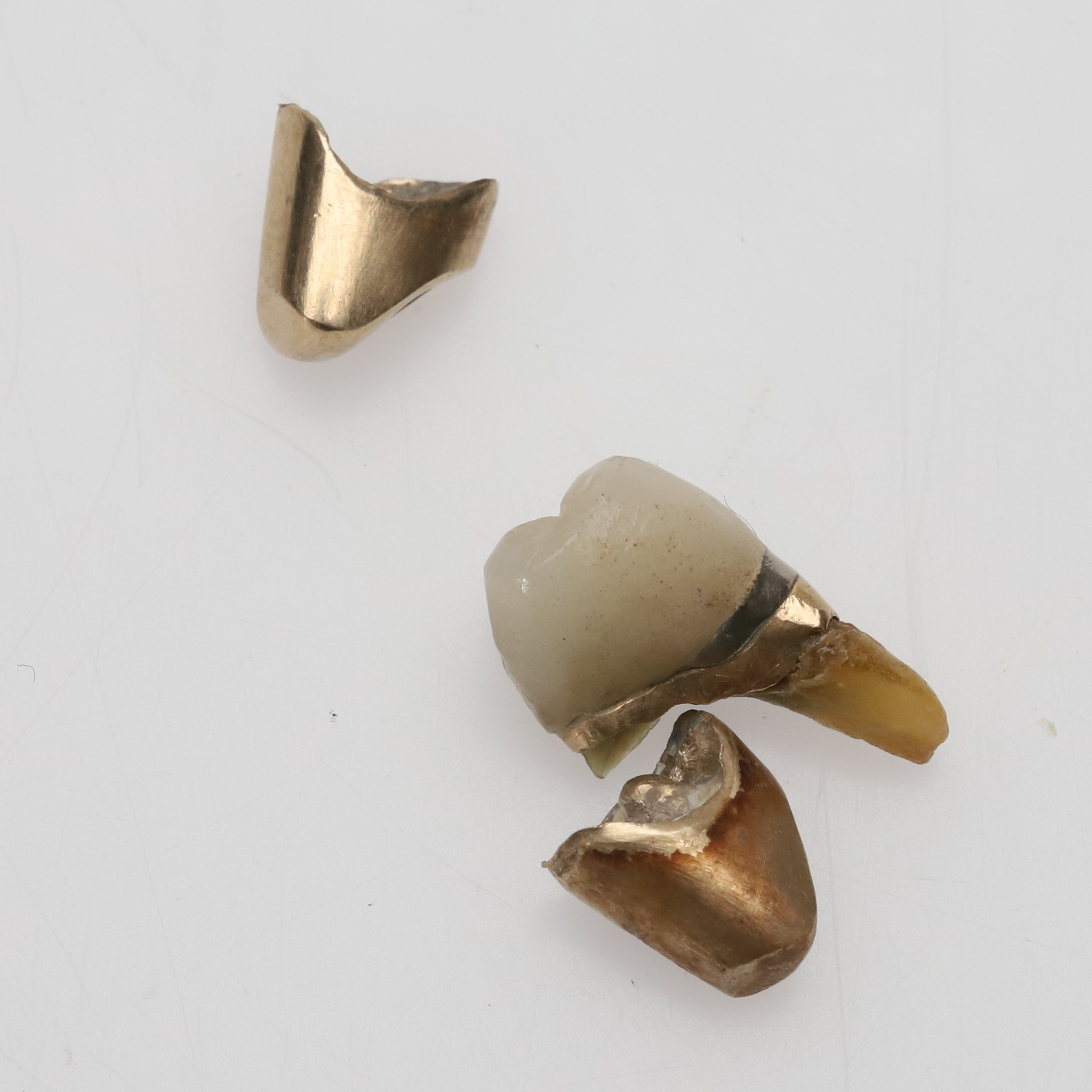 Tandguld, delvis rensat, 8,8g.